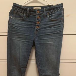 Madewell exposed button denim